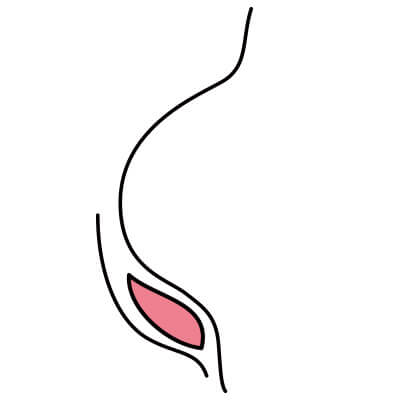 付属パッドのみ
