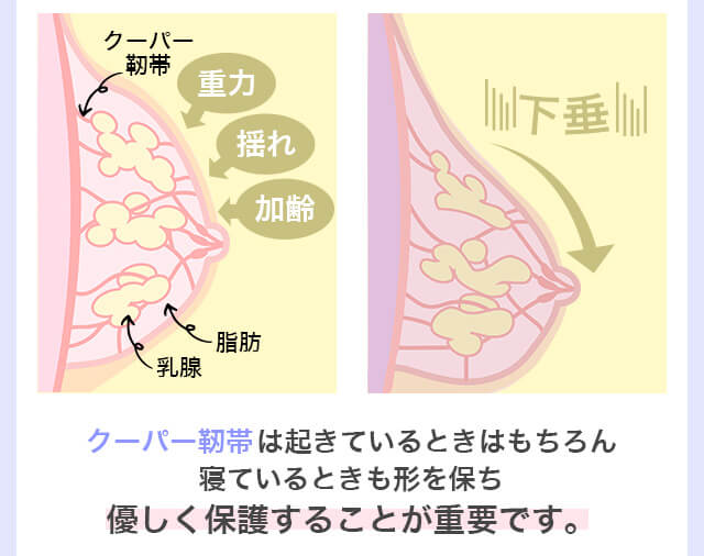 ナイトブラ
